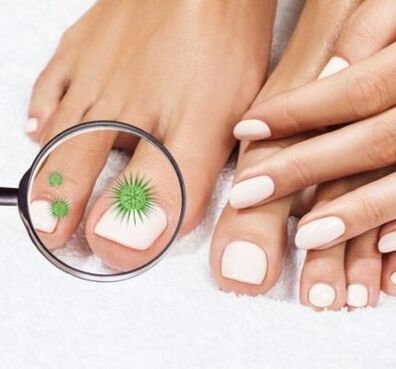 Nail infection through a magnification