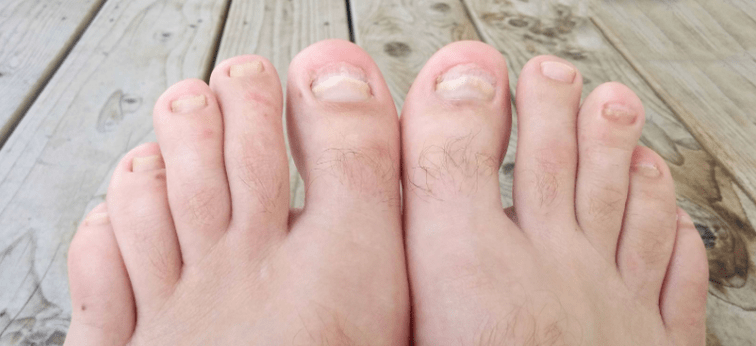 Nail trunk