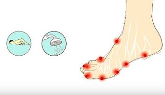 Causes of fungi on toes