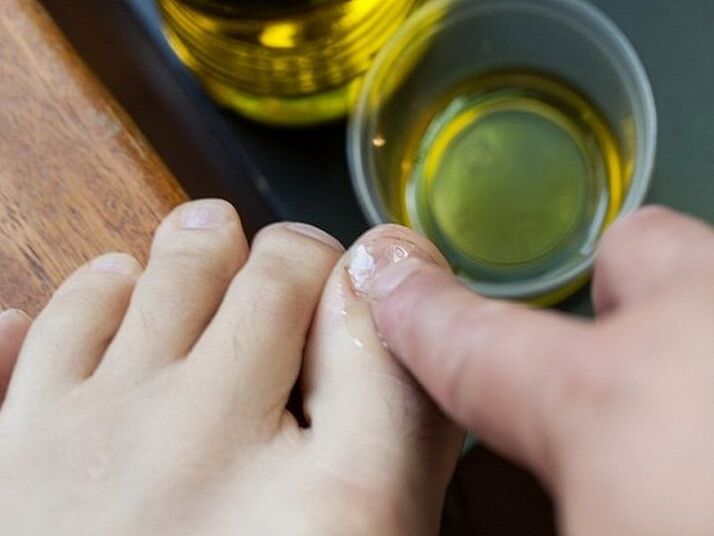 Applying medicated oil to nails affected by fungus