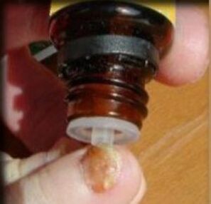 Applying drops to toenails affected by fungus