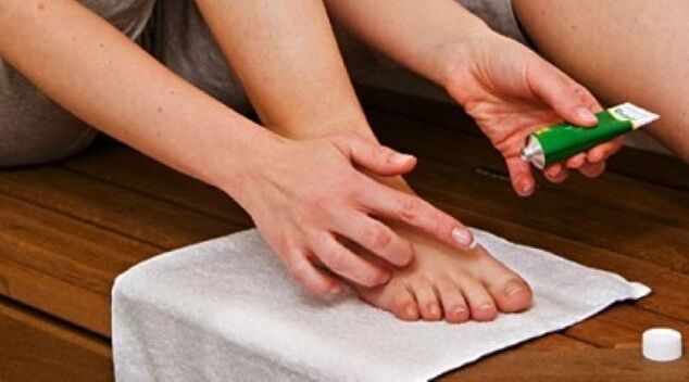 treatment of nail fungus with ointment